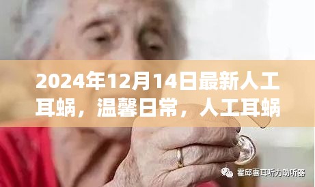 人工耳蜗的奇妙友谊之旅，温馨日常与最新技术进展（2024年）