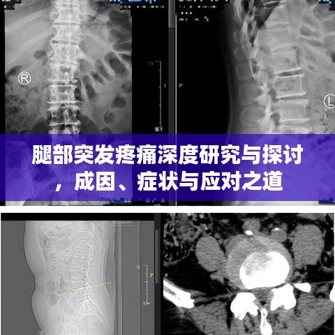 腿部突发疼痛深度研究与探讨，成因、症状与应对之道