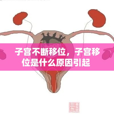 子宫不断移位，子宫移位是什么原因引起 