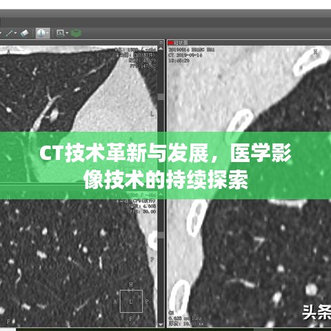CT技术革新与发展，医学影像技术的持续探索