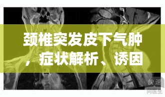 颈椎突发皮下气肿，症状解析、诱因探究及应对之策