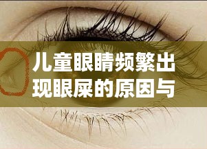 儿童眼睛频繁出现眼屎的原因与解决方法