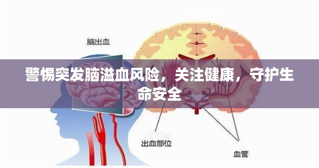 警惕突发脑溢血风险，关注健康，守护生命安全