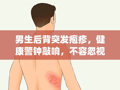 男生后背突发疱疹，健康警钟敲响，不容忽视！