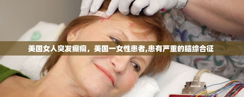 美国女人突发癫痫，美国一女性患者,患有严重的脑综合征 