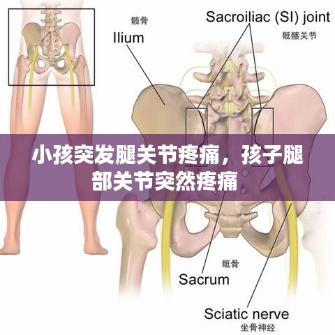 小孩突发腿关节疼痛，孩子腿部关节突然疼痛 