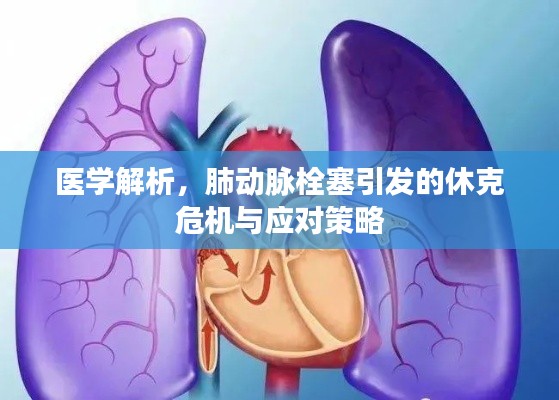 医学解析，肺动脉栓塞引发的休克危机与应对策略