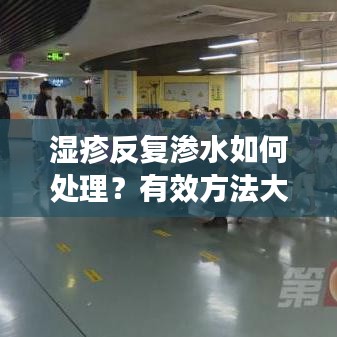 湿疹反复渗水如何处理？有效方法大揭秘