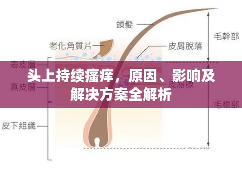 头上持续瘙痒，原因、影响及解决方案全解析