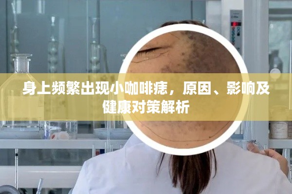 身上频繁出现小咖啡痣，原因、影响及健康对策解析